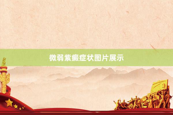 微弱紫癜症状图片展示